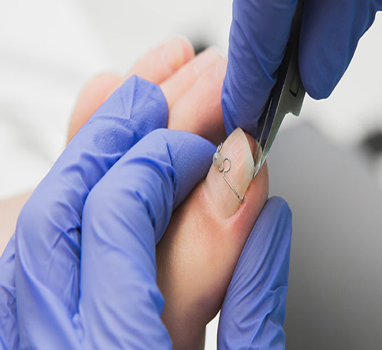 اورتونیل و پودولوژی (Orthonil and podology)